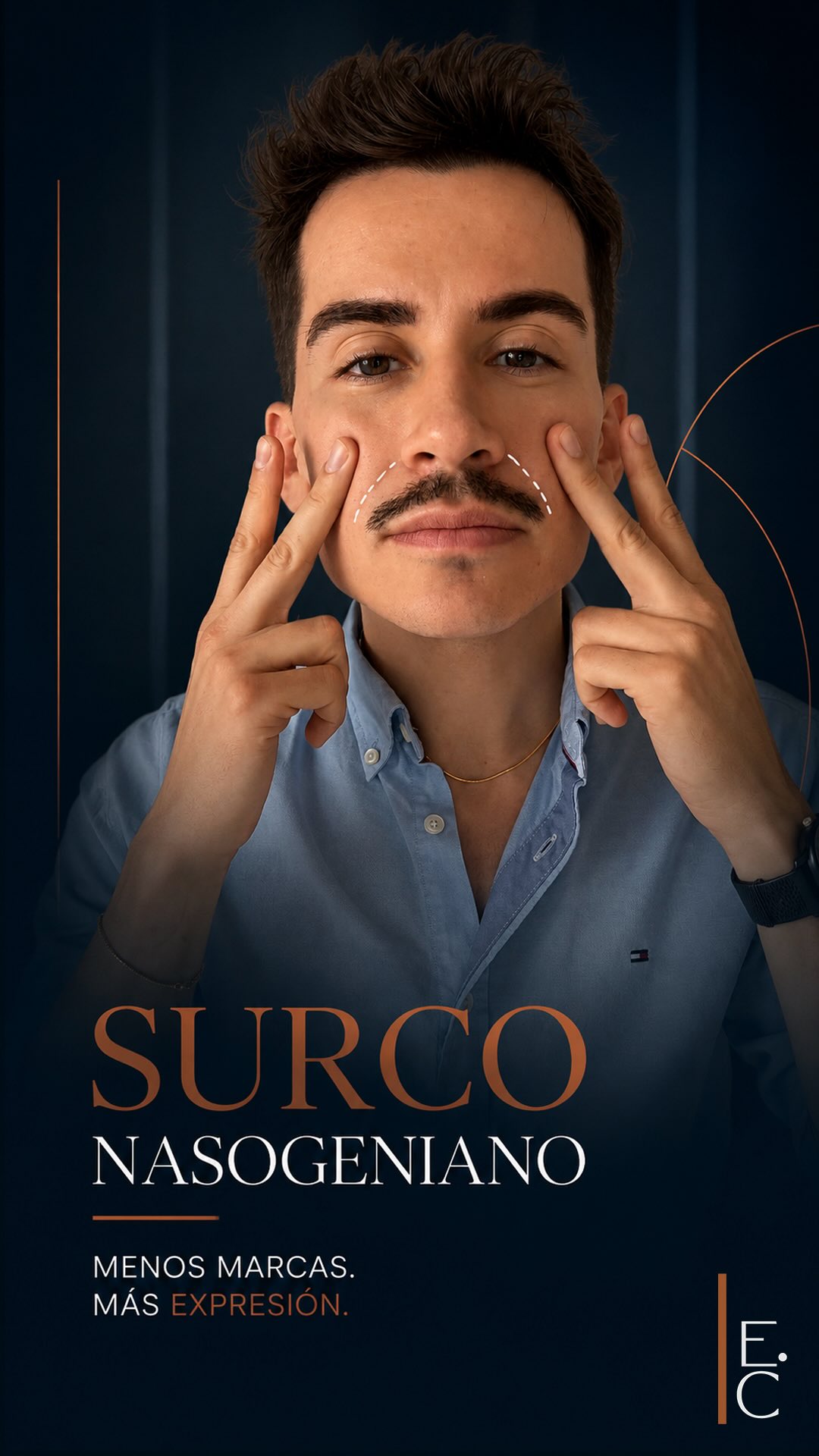 El Dr. Camargo señalando con los dedos el surco nasogeniano en su propio rostro